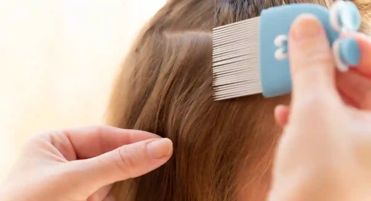 head lice