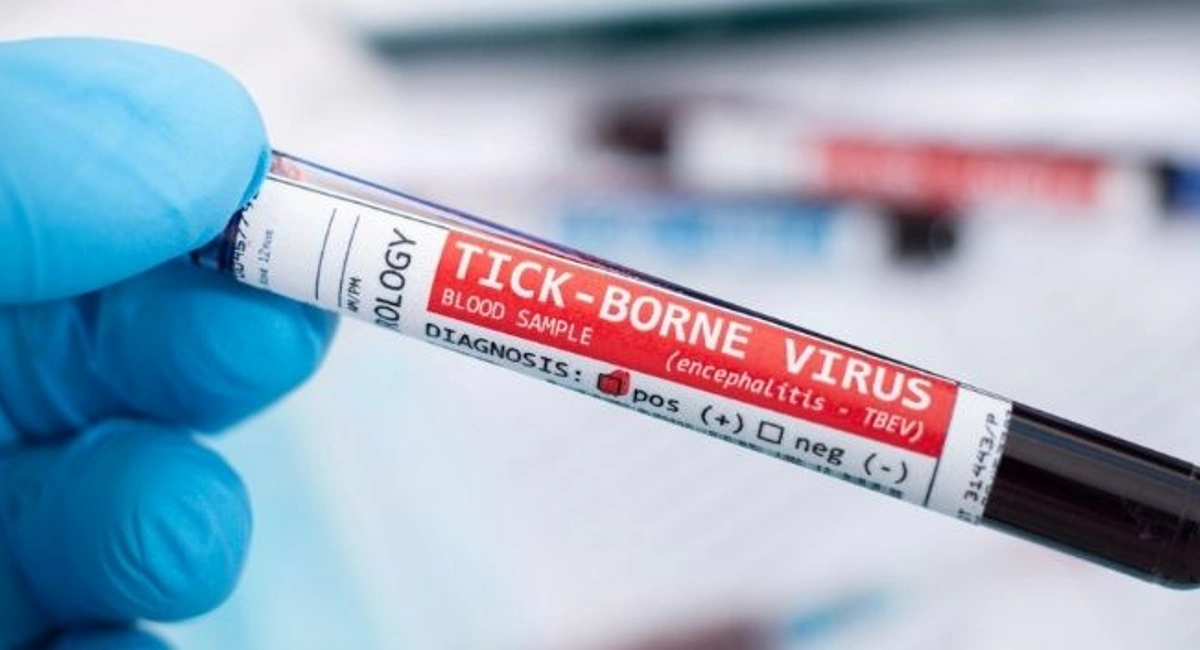 Doctor wearing a blue medical glove holding a blood sample labeled tick-borne virus.